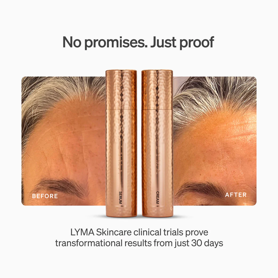 Lyma - LYMA Skincare - Image 3