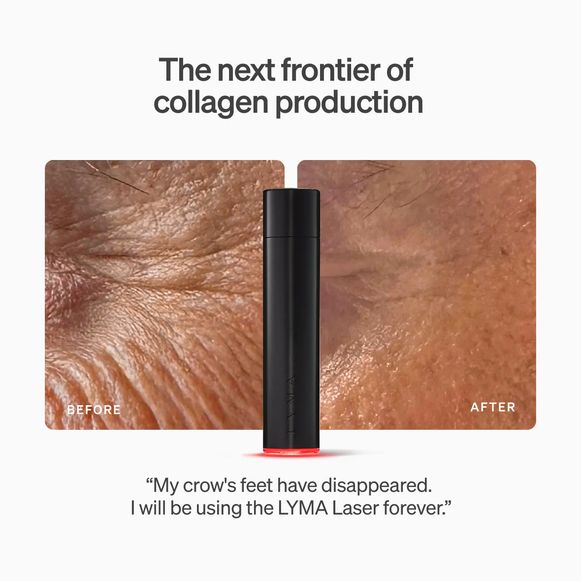Lyma - The LYMA Laser - Image 3